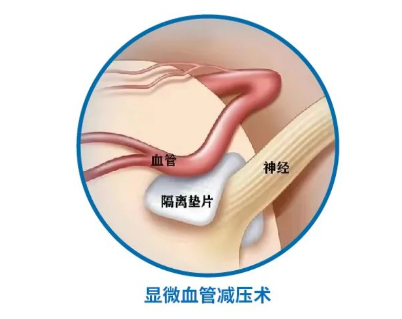 香港新版挂牌之全篇